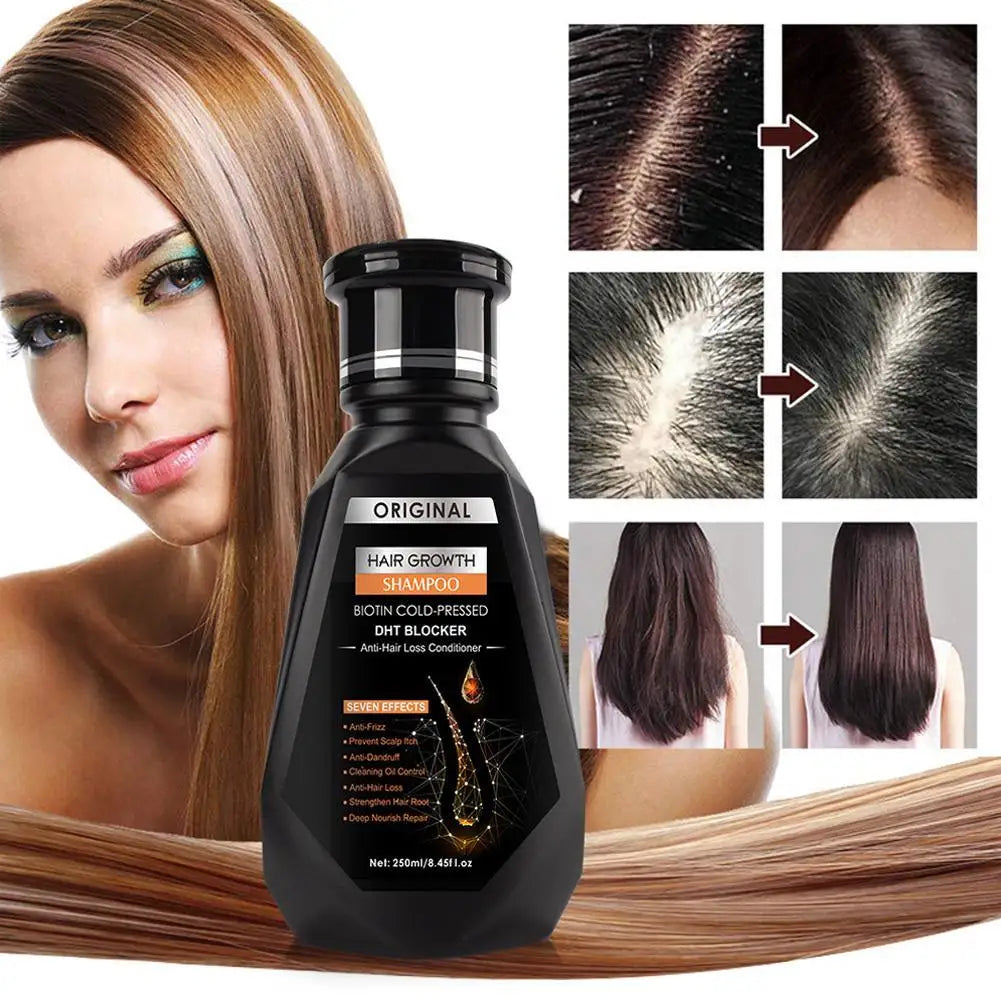 Biotin & Ginger Anti-Hair Loss Shampoo – DHT Blocker, Cold-Pressed - Inarah Trade Ltd