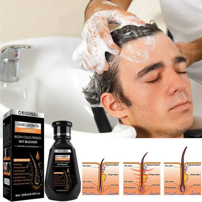 Biotin & Ginger Anti-Hair Loss Shampoo – DHT Blocker, Cold-Pressed - Inarah Trade Ltd