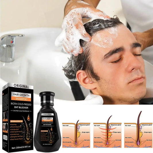 Biotin & Ginger Anti-Hair Loss Shampoo – DHT Blocker, Cold-Pressed - Inarah Trade Ltd
